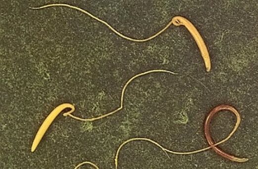 камшичен червей от човешкото тяло
