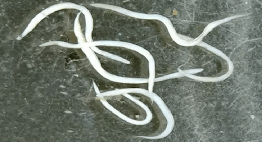 острици в човешкото тяло