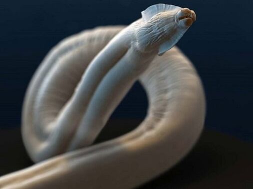 токсокара от човешкото тяло