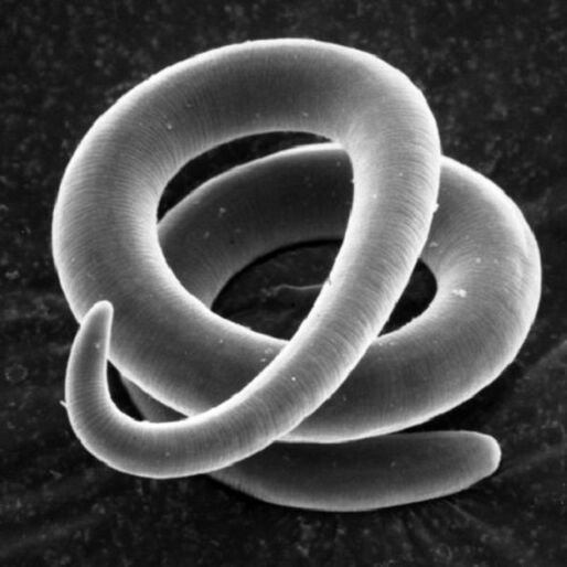 червей паразит трихинела при хората