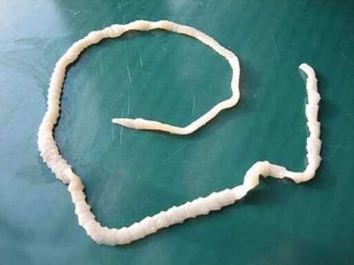 човешка свинска тения