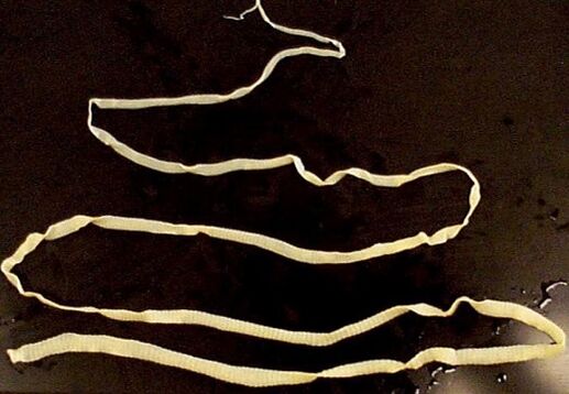 широка тения от човешкото тяло