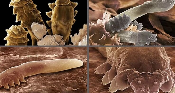 видове човешки кожни паразити