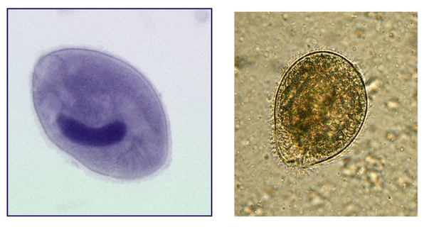 Balantidia ciliates, паразитиращи в дебелото черво
